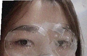 요즘 눈 상태