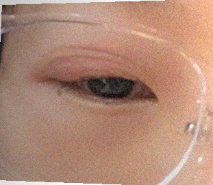 요즘 눈 상태