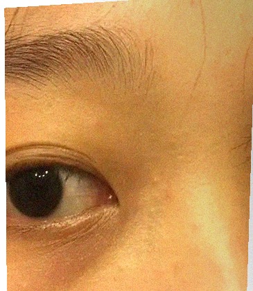 요즘 눈 상태