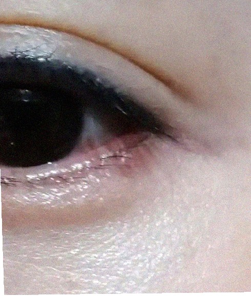 요즘 눈 상태