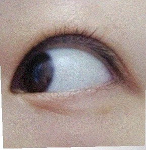 요즘 눈 상태