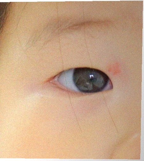 요즘 눈 상태