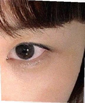 요즘 눈 상태