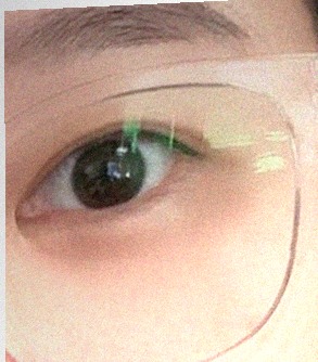 요즘 눈 상태