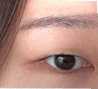 요즘 눈 상태