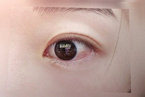 요즘 눈 상태