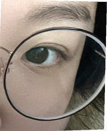 요즘 눈 상태