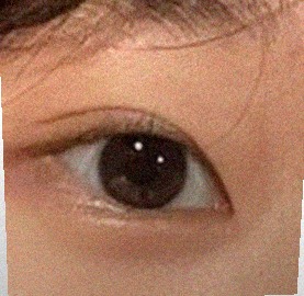 요즘 눈 상태