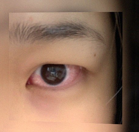 요즘 눈 상태