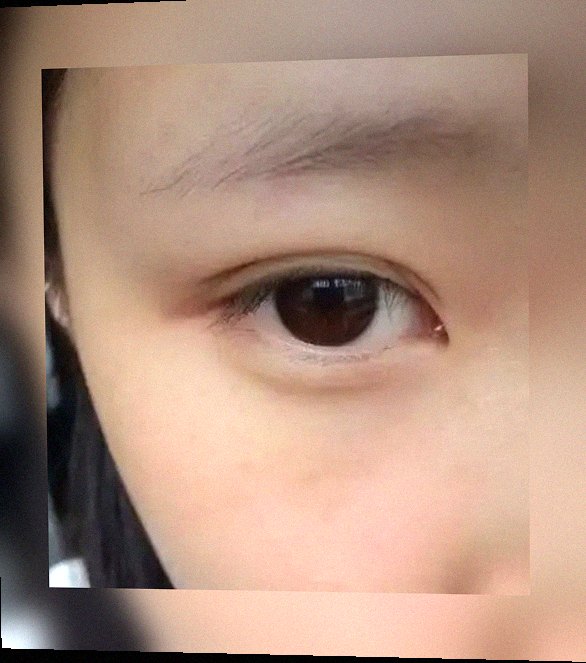 요즘 눈 상태