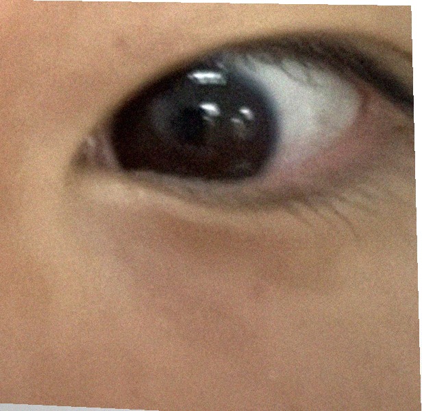 요즘 눈 상태