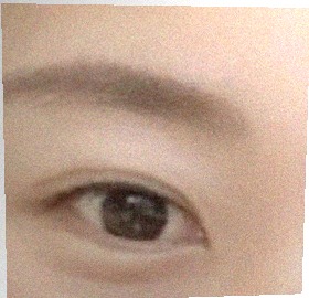 요즘 눈 상태