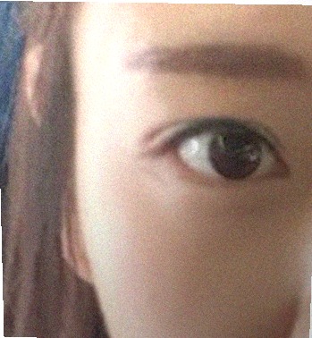요즘 눈 상태