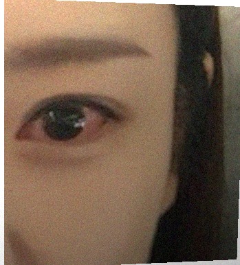 요즘 눈 상태