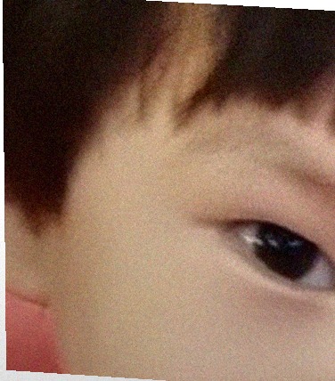 요즘 눈 상태