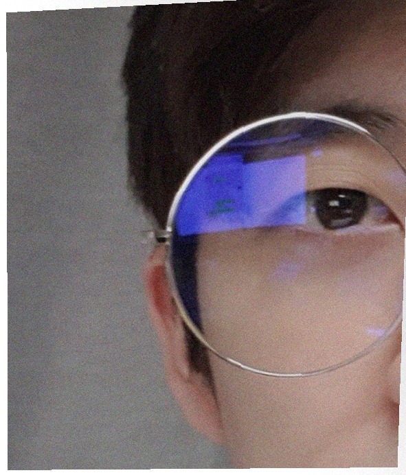 요즘 눈 상태