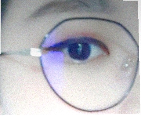 요즘 눈 상태