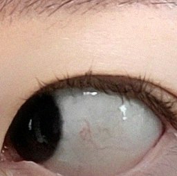 요즘 눈 상태