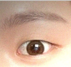 요즘 눈 상태