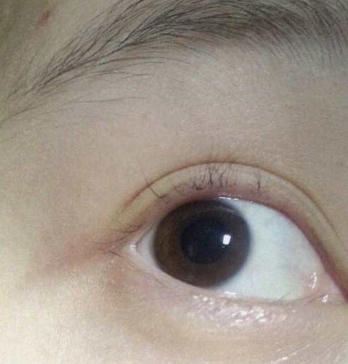 요즘 눈 상태