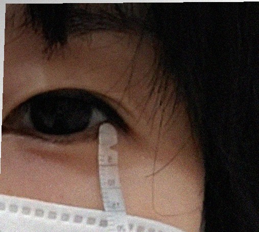 요즘 눈 상태