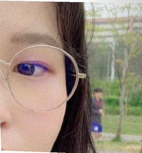 요즘 눈 상태