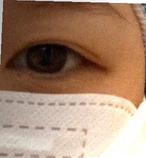 요즘 눈 상태