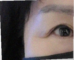 요즘 눈 상태