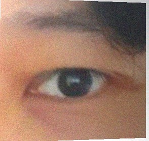 요즘 눈 상태