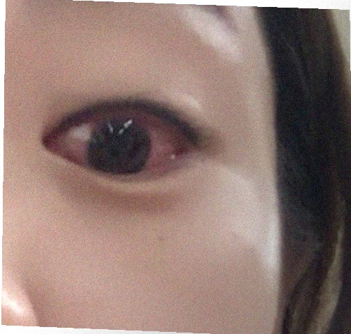요즘 눈 상태