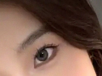 요즘 눈 상태