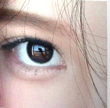 요즘 눈 상태