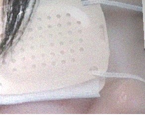 요즘 눈 상태
