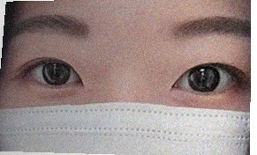 요즘 눈 상태