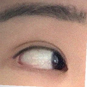 요즘 눈 상태