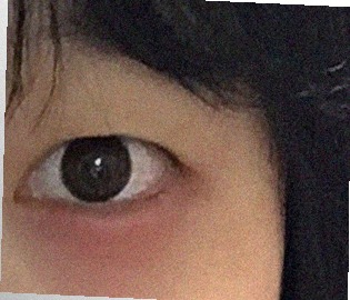 요즘 눈 상태