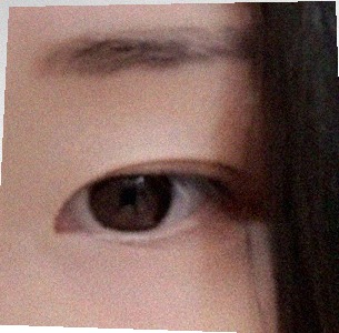 요즘 눈 상태