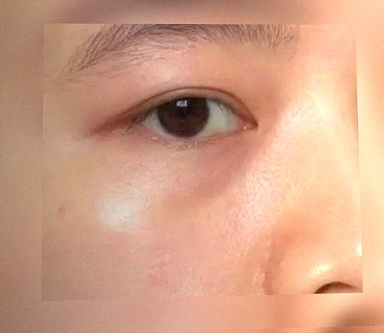요즘 눈 상태