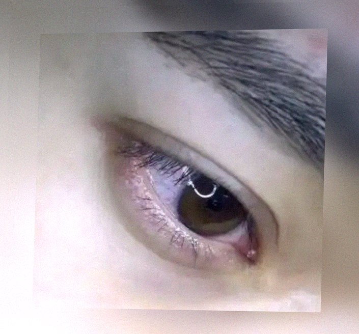 요즘 눈 상태