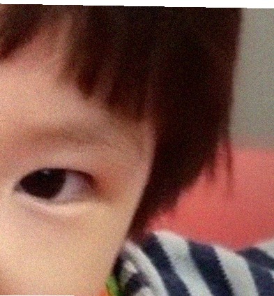 요즘 눈 상태