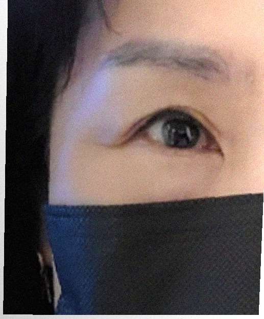 요즘 눈 상태