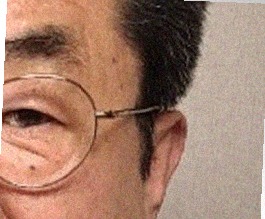 요즘 눈 상태