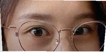 요즘 눈 상태