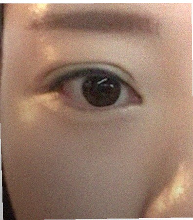 요즘 눈 상태