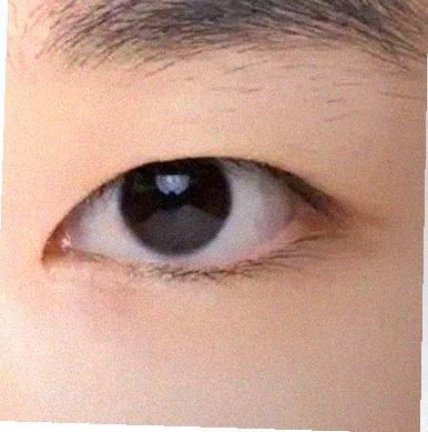 요즘 눈 상태