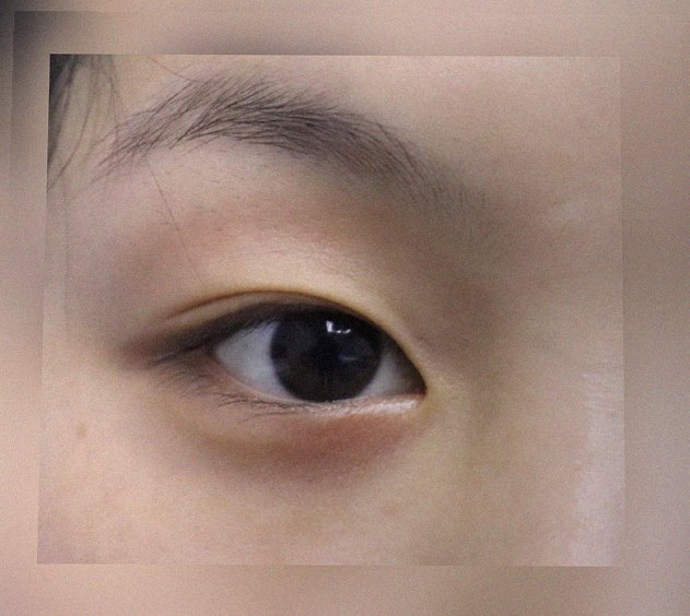 요즘 눈 상태