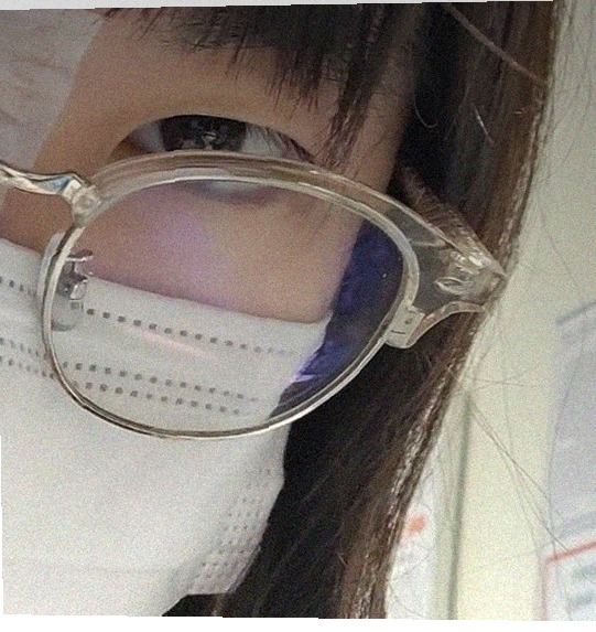 요즘 눈 상태