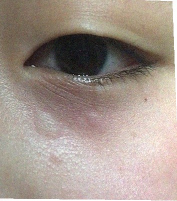 요즘 눈 상태