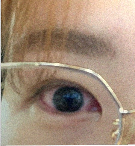 요즘 눈 상태