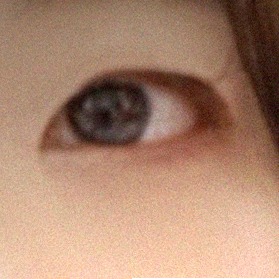 요즘 눈 상태